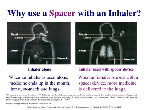 PPT - Why use a Spacer with an Inhaler? PowerPoint Presentation, free ...