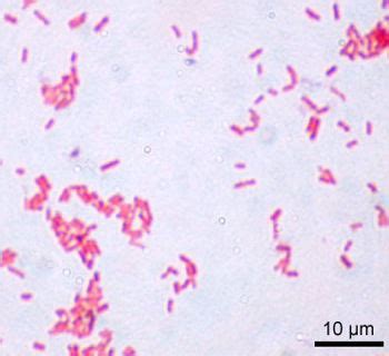 The Genesis of Pathogenic E. coli | Answers in Genesis