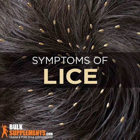 Lice: Symptoms, Causes & Treatment by James Denlinger