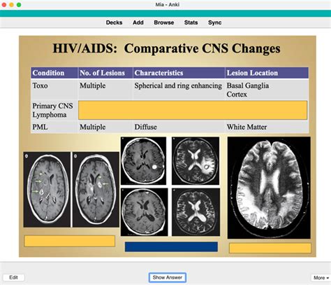 Essential Anki Add-Ons for Medical Students - Everything Med School