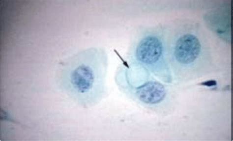 Chlamydia trachomatis au microscope optique | Download Scientific Diagram