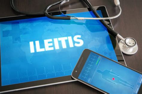 ILEITIS