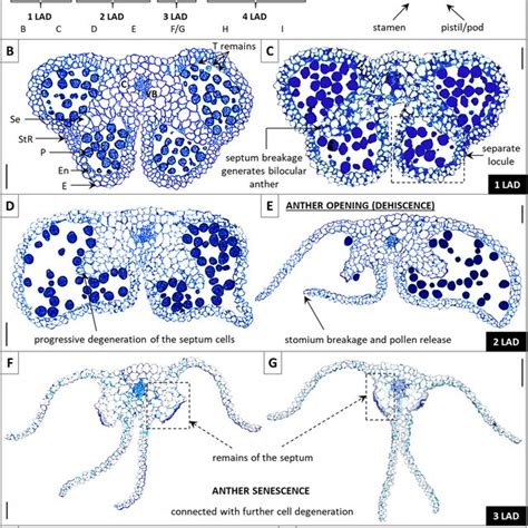 A Individual stages of flower (1F–10F) development in yellow lupine ...