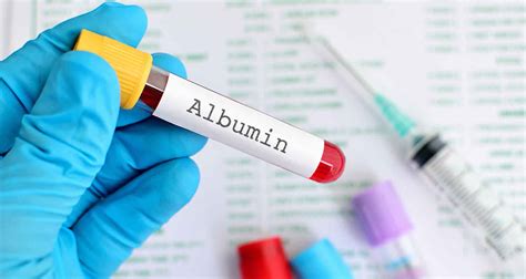 Hypoalbuminemia causes, symptoms, diagnosis, treatment & prognosis