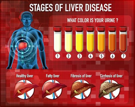 Free Vector | Stages of liver disease