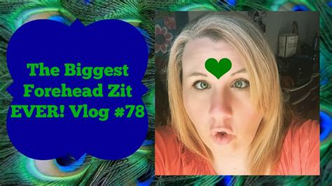 The Biggest Forehead Zit EVER! Vlog #78 - YouTube