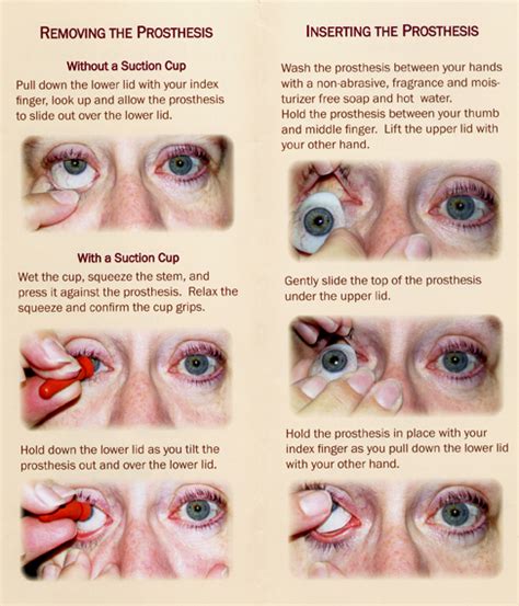 Insert and Remove Ocular Prosthesis ~ Kolberg Ocularist~Custom Made Artificial Eyes and Flush ...