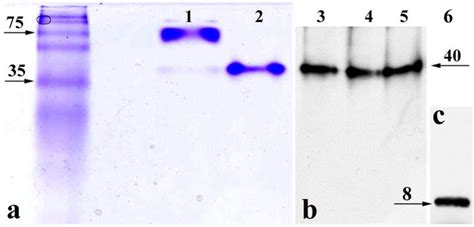 Toxins | Special Issue : Enterotoxins