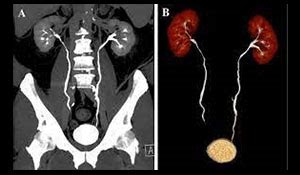 Computed Tomography – CT Scan – ScanLab Center