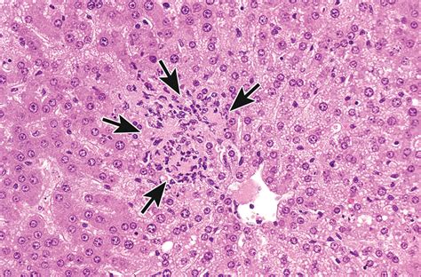 Recommendations from the INHAND Apoptosis/Necrosis Working Group - Susan A. Elmore, Darlene ...