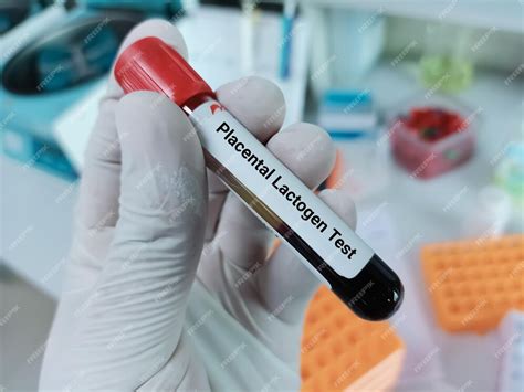 Premium Photo | Scientist holds blood sample for human placental ...