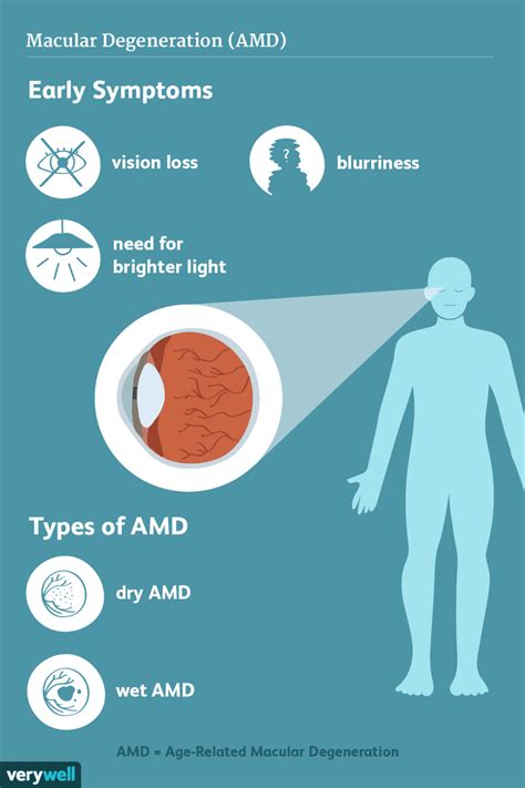 Macular Degeneration: Signs and Symptoms