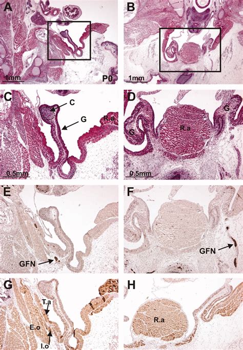 Gubernaculum Testis Tail