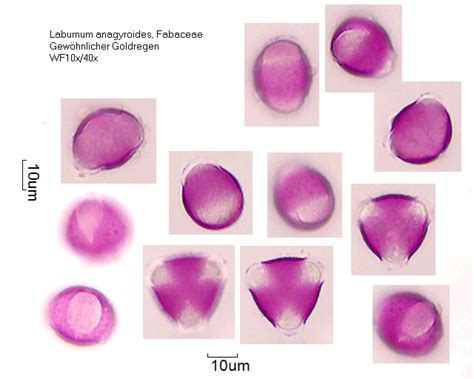 Datei:Laburnum anagyroides (2).jpg – Pollen-Wiki