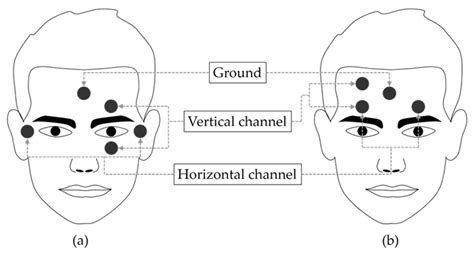 Eye-blinks: positive or negative? — OpenBCI Forum