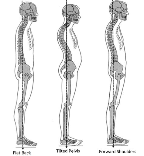 CK Clinic – Standing Posture