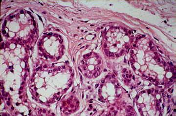 Mammary Gland Histology