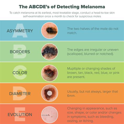 Dangers of Melanoma - Skin Cancer Awareness Month