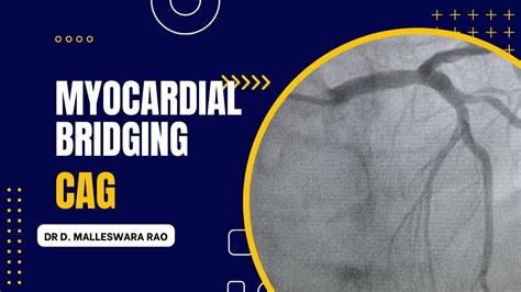 MYOCARDIAL BRIDGE IN LAD | Dr. D. Malleswara Rao | Coronary Angiogram ...