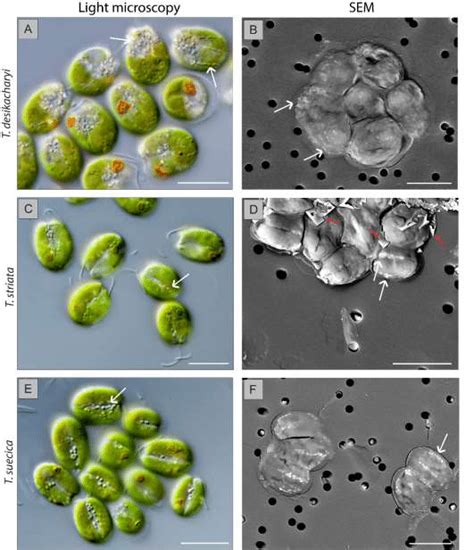 Main micropearl distribution patterns observed in Tetraselmis species.... | Download Scientific ...