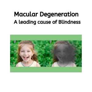 Macular Degeneration: a leading cause of Blindness