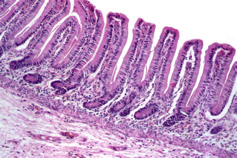 Stomach Histology Rugae