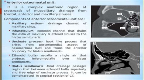 Surgical anatomy of osteomeatal complex