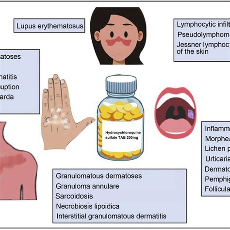 Potential Adverse Effects of Hydroxychloroquine | Download Scientific Diagram