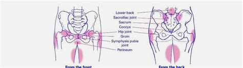 Pelvic Girdle Pain Pregnancy