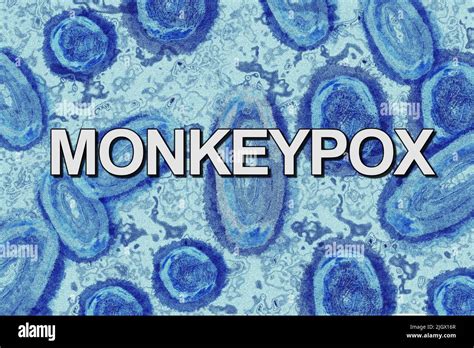 Smallpox virus microscope hi-res stock photography and images - Alamy