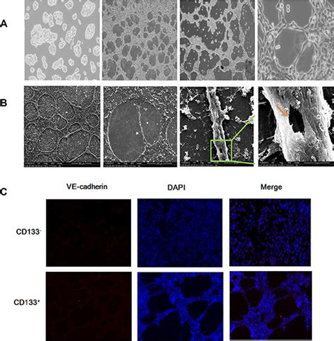 Oncotarget | CD133 + cancer stem-like cells promote migration and invasion of salivary adenoid ...