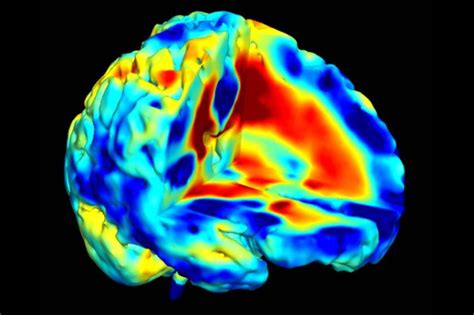 First anatomical evidence of several types of schizophrenia | New Scientist