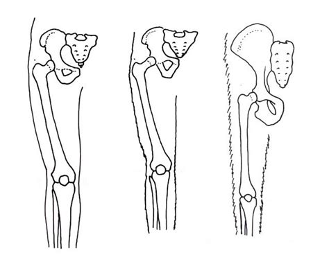 Walking on two legs – bipedalism - The Australian Museum