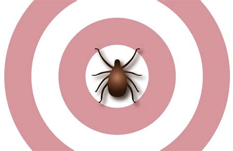 Lyme Disease, Tick, Bulls-eye Rash - Reliant Medical Group