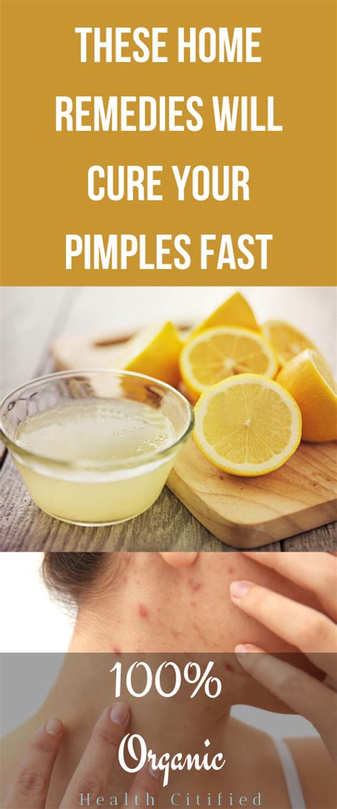 How To Remove Pimples: 5 Natural Pimple Treatments | Pimple treatment, How to remove pimples ...