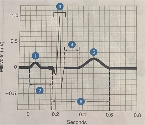 Sections of a normal ECG, lead II Diagram | Quizlet