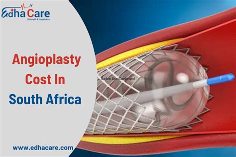 Angioplasty Cost In South Africa - EdhaCare