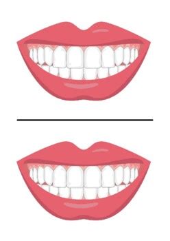 Mouth And Teeth Template