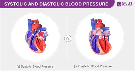 Blood pressure- Types of Blood Pressure and its Differences