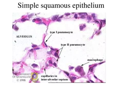 PPT - Simple squamous epithelium PowerPoint Presentation, free download ...