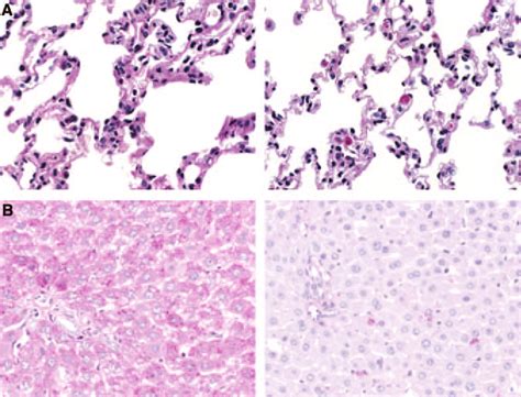 PAS staining of the lung (A) and the liver (B) in a wild-type (left)... | Download Scientific ...