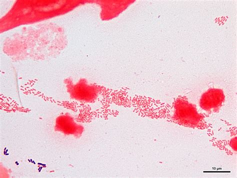 Haemophilus Ducreyi Gram Stain