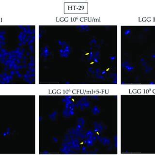 Nuclear morphological changes in HT-29 cells observed following 48 h ...