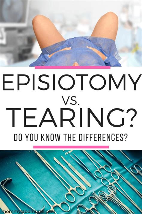 Episiotomy Vs. Tearing: Do You Know Which One is Better? Tearing during ...