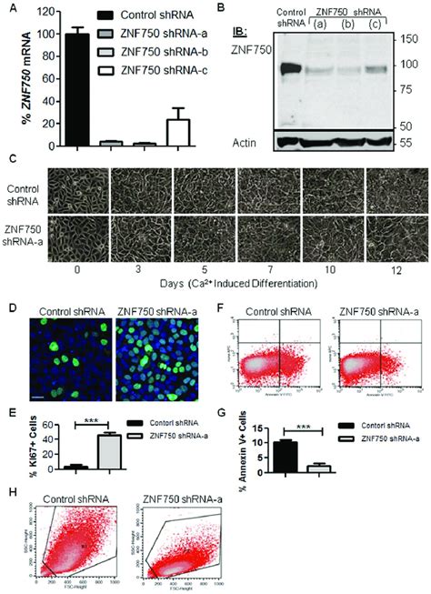 ZNF750 silencing in HaCaT keratinocytes. HaCaT cells were transduced ...