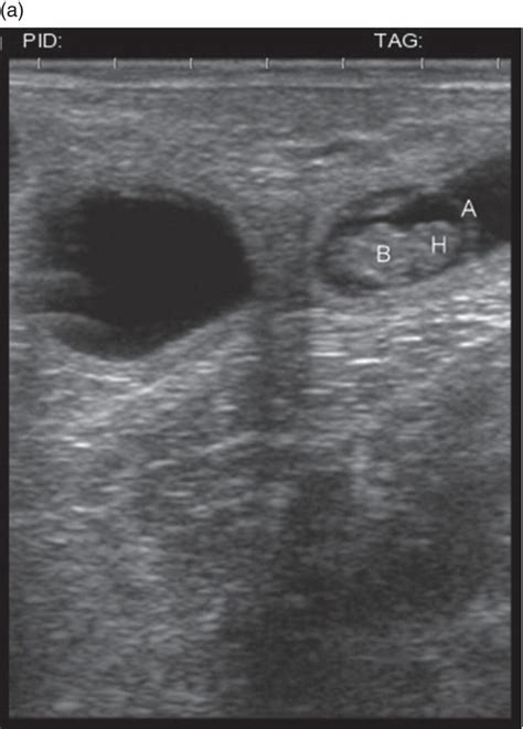 Reproductive Ultrasound of Female Cattle | Veterian Key