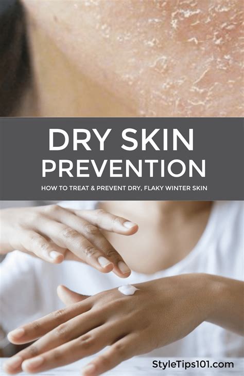 Flaky, Dry Skin Prevention and Treatment