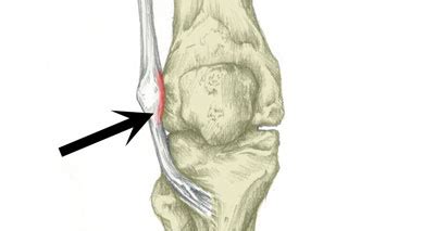 Side Of Knee Pain Burning