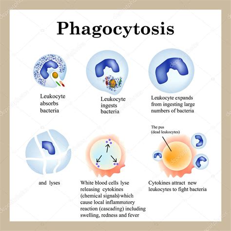 Fagocitosis. El proceso de destrucción de bacterias por los leucocitos. Ilustración vectorial ...