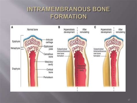 Pathophysiology of fracture healing